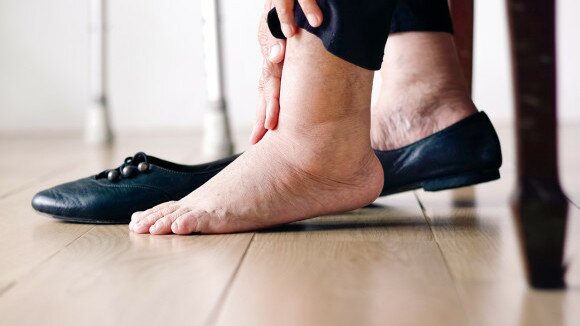 长者足部问题的护理及治疗方法